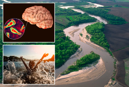 可怕！一名儿童游泳后死于罕见疾病感染2