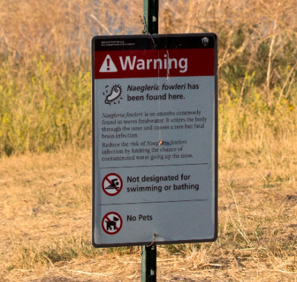 可怕！一名儿童游泳后死于罕见疾病感染3