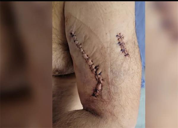 卑诗省沃尔玛刺伤案嫌疑人被判无罪，尽管被随身摄像机拍摄了过程2