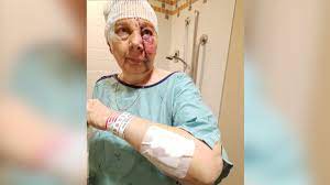 【广播】安省妇女在公寓遭到狗的暴力袭击，狗主被指控2