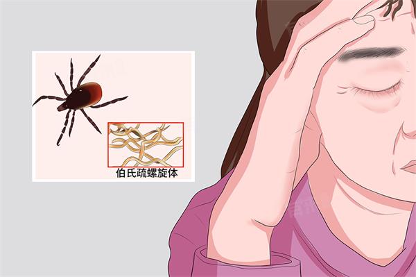 加拿大莱姆病病例“稳步增长”，这些是你需要了解信息1