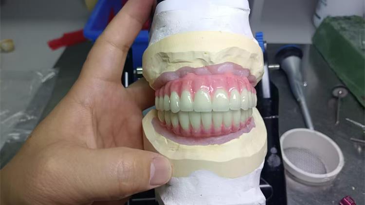 深圳义齿加工厂 诚邀海外华人各位牙科医生，牙科技师，牙诊所和代理的加入